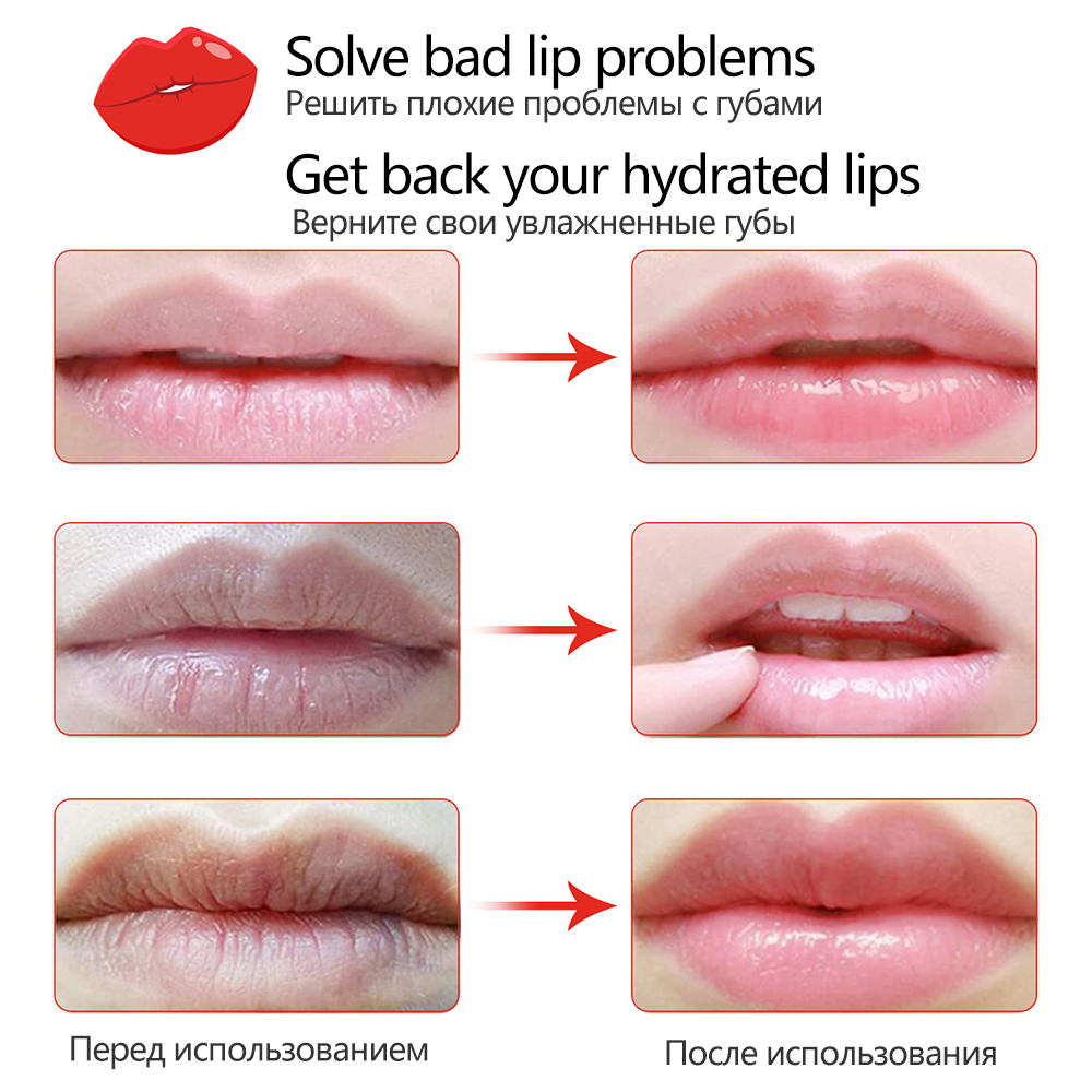 Fruit-Vitamin-C-Lip-Mask-Moisturizing-Skin-Reducing-Lip-Wrinkles-Repair-Chapped-Lip-Patches-Beauty-Health-3